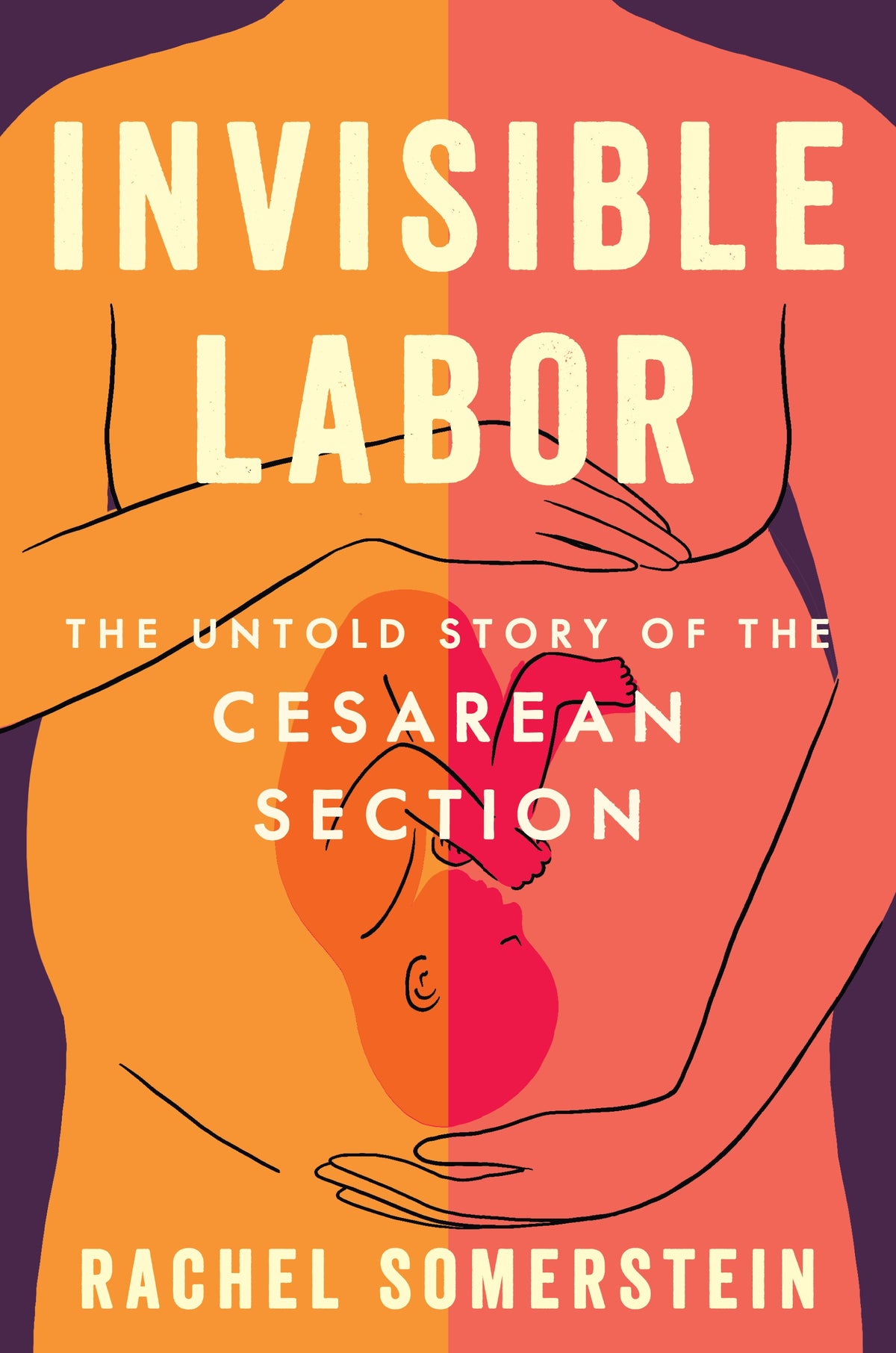 Invisible Labor: The Untold Story of the Cesarean Section;  Rachel Somerstein